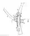 Fig. 07 - Procedures for vascular occlusion