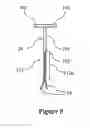 Fig. 06 - Intrauterine device with a restricted upward movement of a string