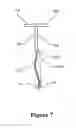 Fig. 08 - Intrauterine device with a restricted upward movement of a string