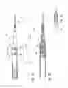 Fig. 09 - Intraocular shunt placement
