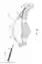 Fig. 12 - Intraocular shunt placement