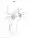 Fig. 05 - Motion assistance apparatus