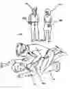 Fig. 01 - CARDIOPULMONARY RESUSCITATION COORDINATION METHOD, COMPUTER PROGRAM PRODUCT AND SYSTEM