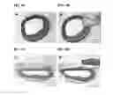Fig. 07 - Intravascular delivery of nanoparticle compositions and uses thereof