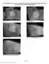 Fig. 46 - Foamable formulation