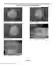 Fig. 50 - Foamable formulation