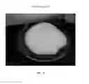 Fig. 75 - Foamable formulation
