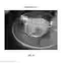 Fig. 76 - Foamable formulation