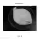 Fig. 77 - Foamable formulation