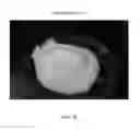Fig. 79 - Foamable formulation