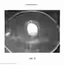 Fig. 80 - Foamable formulation