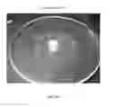 Fig. 84 - Foamable formulation