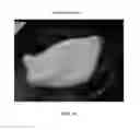 Fig. 85 - Foamable formulation