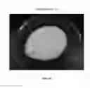 Fig. 86 - Foamable formulation
