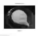 Fig. 88 - Foamable formulation