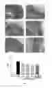 Fig. 04 - Use of andrographolide derivatives in preparation of medicaments for preventing and treating inflammatory bowel diseases
