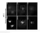Fig. 02 - PAR1 MODULATION TO ALTER MYELINATION