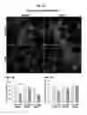 Fig. 03 - PAR1 MODULATION TO ALTER MYELINATION