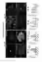 Fig. 04 - PAR1 MODULATION TO ALTER MYELINATION