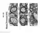Fig. 20 - PAR1 MODULATION TO ALTER MYELINATION