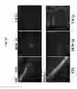 Fig. 24 - PAR1 MODULATION TO ALTER MYELINATION