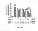 Fig. 04 - METHOD OF SUPPRESSING INFLAMMATION AND PROMOTING REPAIR OF INJURED NEURAL TISSUES WITH CARBOXYL-FUNCTIONALIZED POLYURETHANE NANOPARTICLES
