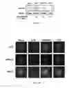 Fig. 06 - METHOD OF SUPPRESSING INFLAMMATION AND PROMOTING REPAIR OF INJURED NEURAL TISSUES WITH CARBOXYL-FUNCTIONALIZED POLYURETHANE NANOPARTICLES