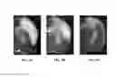 Fig. 11 - METHOD OF SUPPRESSING INFLAMMATION AND PROMOTING REPAIR OF INJURED NEURAL TISSUES WITH CARBOXYL-FUNCTIONALIZED POLYURETHANE NANOPARTICLES