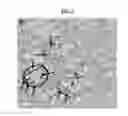 Fig. 04 - Methods and compositions for the prevention or treatment of Barth Syndrome
