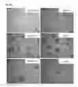 Fig. 15 - BTN3A ECTODOMAIN PROTEINS AND METHODS OF USE
