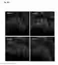 Fig. 25 - BTN3A ECTODOMAIN PROTEINS AND METHODS OF USE