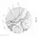Fig. 04 - SYSTEMS AND METHODS FOR SYMPATHETIC CARDIOPULMONARY NEUROMODULATION