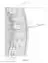 Fig. 11 - SYSTEMS AND METHODS FOR SYMPATHETIC CARDIOPULMONARY NEUROMODULATION