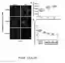 Fig. 11 - CARBON MATERIAL DELIVERY SYSTEMS AND METHODS