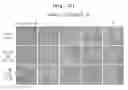 Fig. 11 - Gene therapy vector system and prodrug genes