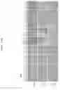 Fig. 16 - Gene therapy vector system and prodrug genes