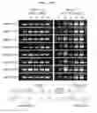 Fig. 31 - Gene therapy vector system and prodrug genes