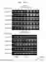 Fig. 82 - Gene therapy vector system and prodrug genes