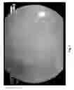 Fig. 03 - SOLID ORAL COMPOSITION CONTAINING DYES