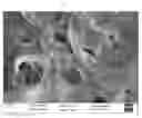 Fig. 04 - Ready to use biodegradable and biocompatible artificial skin substitute and a method of preparation thereof