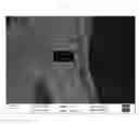 Fig. 05 - Ready to use biodegradable and biocompatible artificial skin substitute and a method of preparation thereof