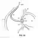 Fig. 08 - Devices, methods and systems for establishing supplemental blood flow in the circulatory system