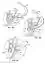 Fig. 14 - Devices, methods and systems for establishing supplemental blood flow in the circulatory system
