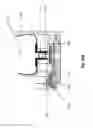 Fig. 22 - Dialysis device and method of dialysis