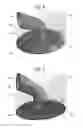 Fig. 04 - Attachment for a tracheal device