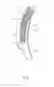 Fig. 04 - Endotracheal Intubation System