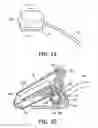 Fig. 11 - Liquid removal in a patient interface assembly