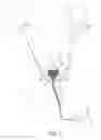Fig. 04 - Catheter device and method for inducing negative pressure in a patient's bladder