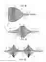 Fig. 06 - Catheter device and method for inducing negative pressure in a patient's bladder