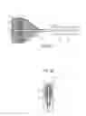Fig. 07 - Catheter device and method for inducing negative pressure in a patient's bladder